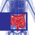 Скрининг рака дебелог црева